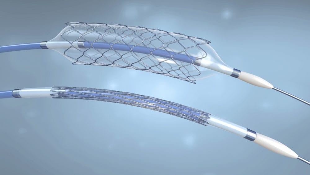 FDA Issues Warning of Stroke, Death Risk With Non-approved Wingspan Stent Use